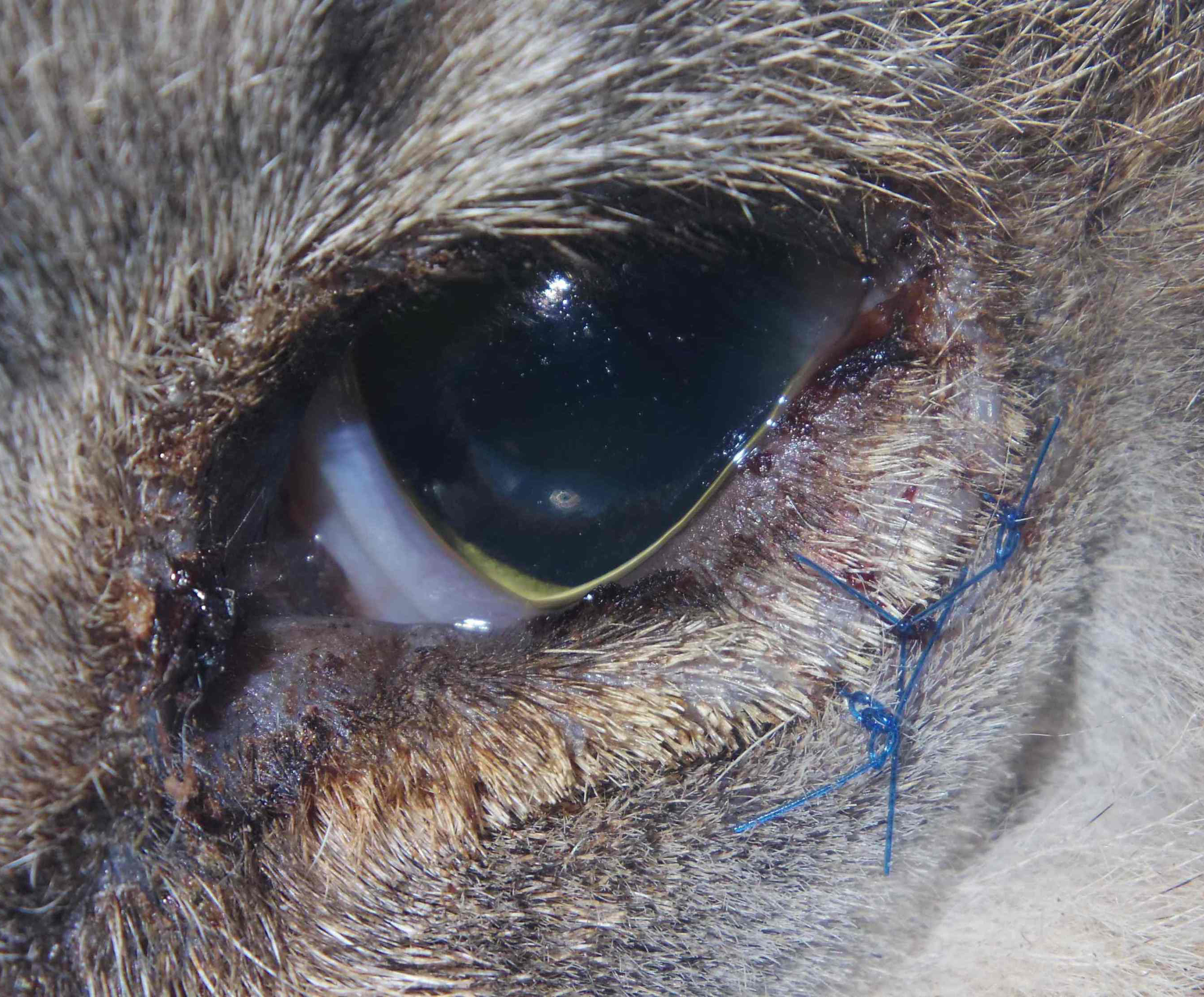 タッキング 内反