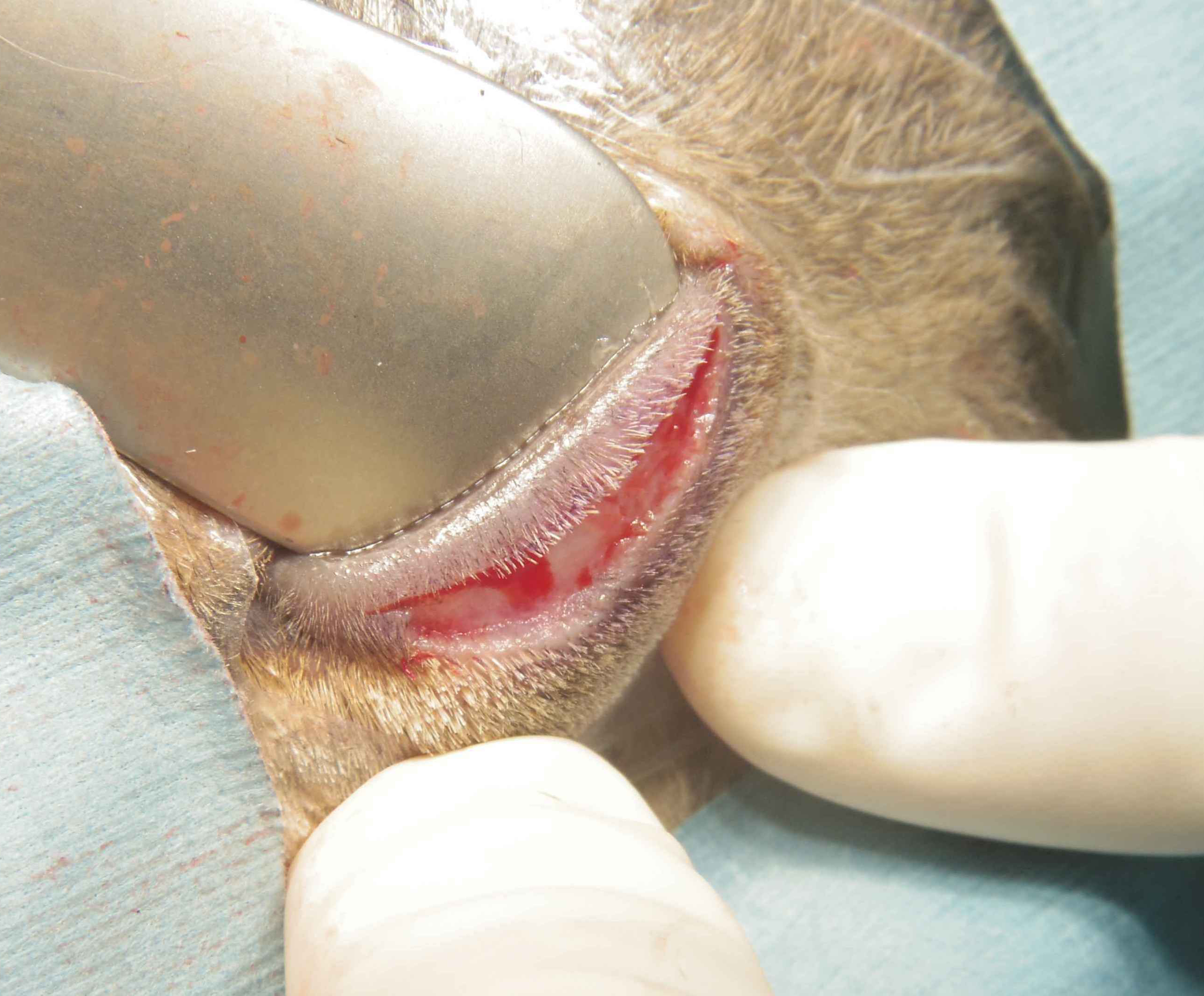 眼瞼内反症 手術