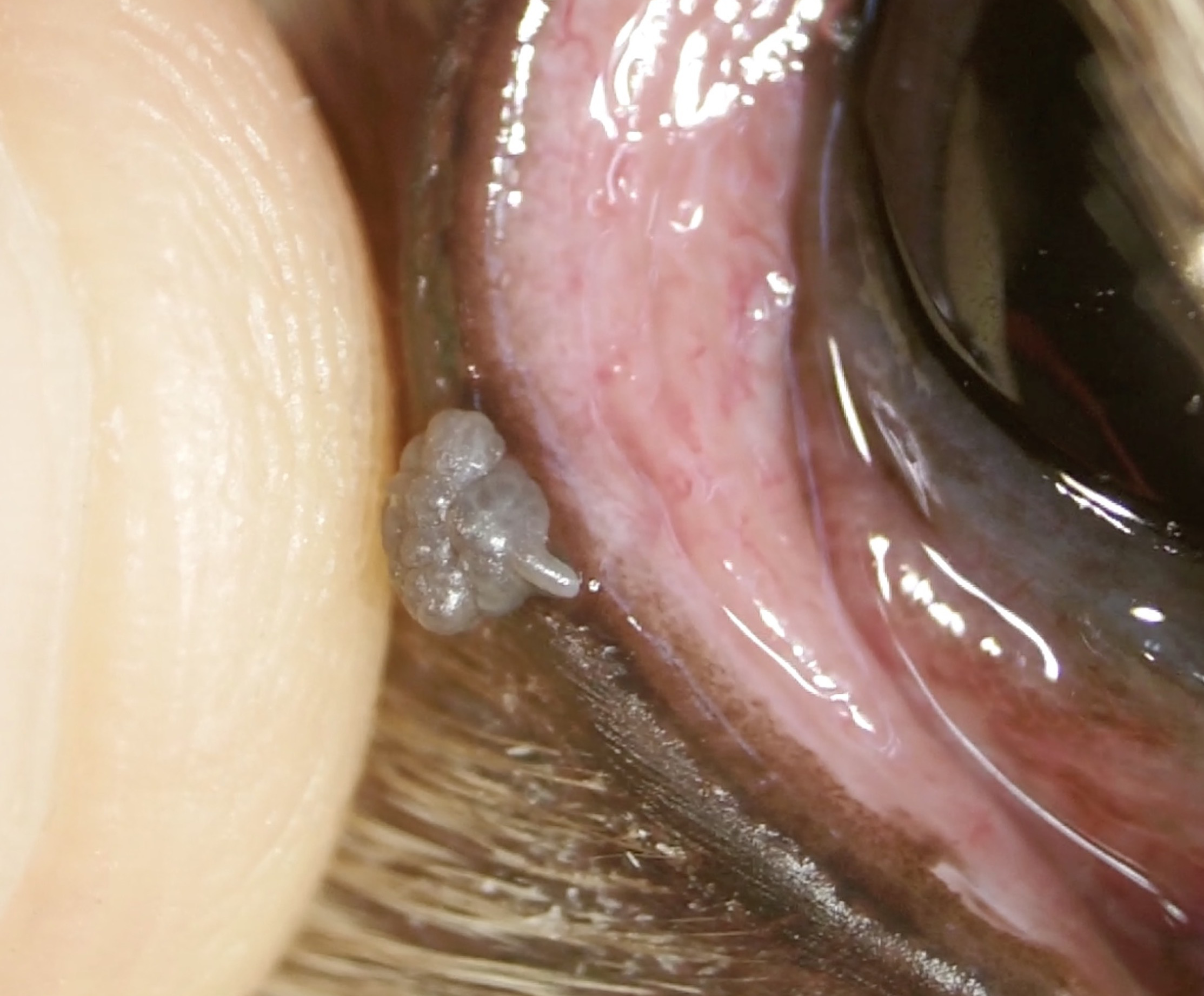 マイボーム腺腫 犬