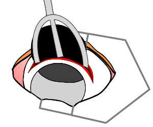 シリコンボール