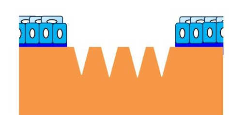 角膜 格子状切開