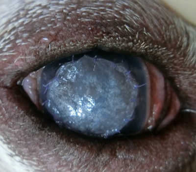 角膜潰瘍 人工膜