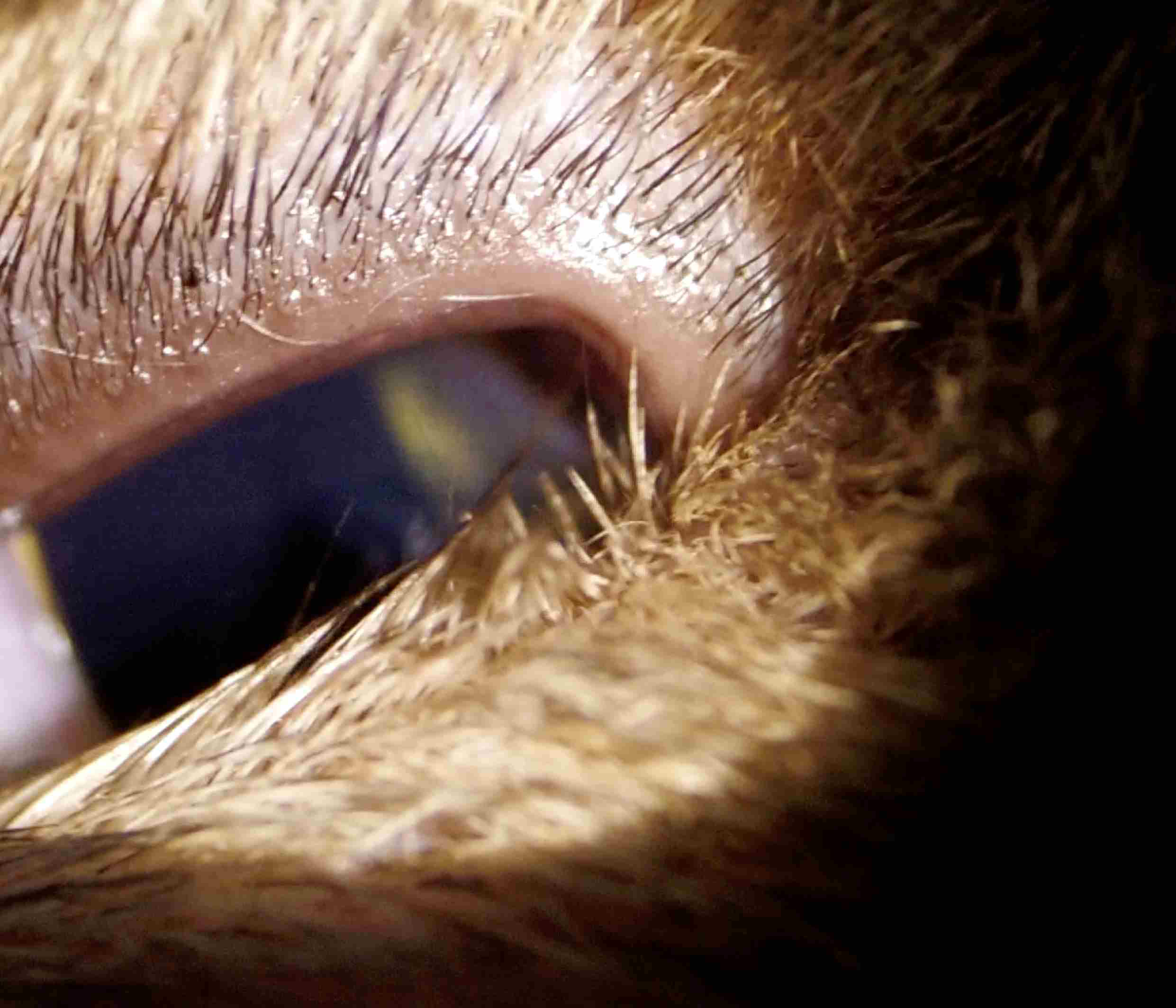 タッキング 内反