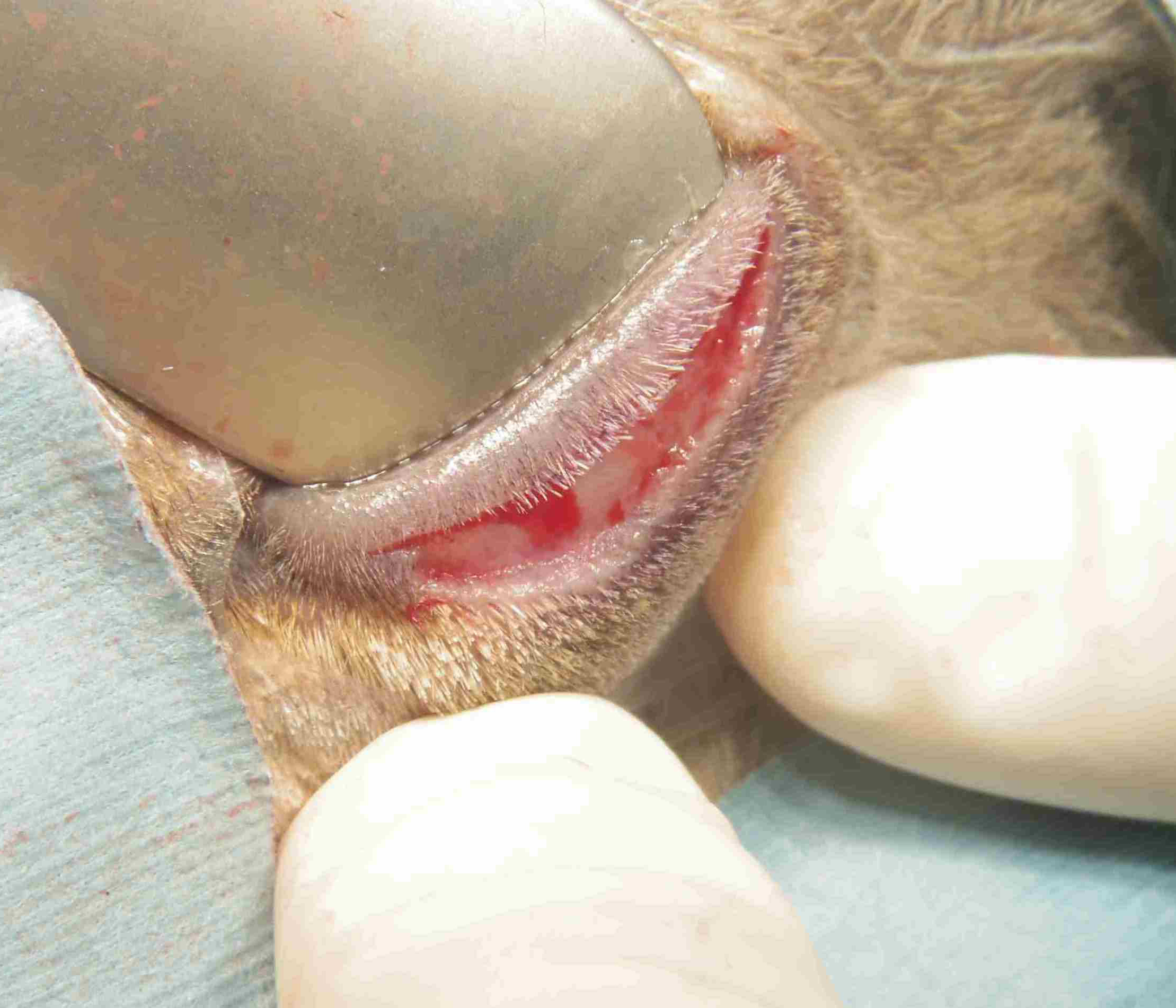 タッキングスーチャー