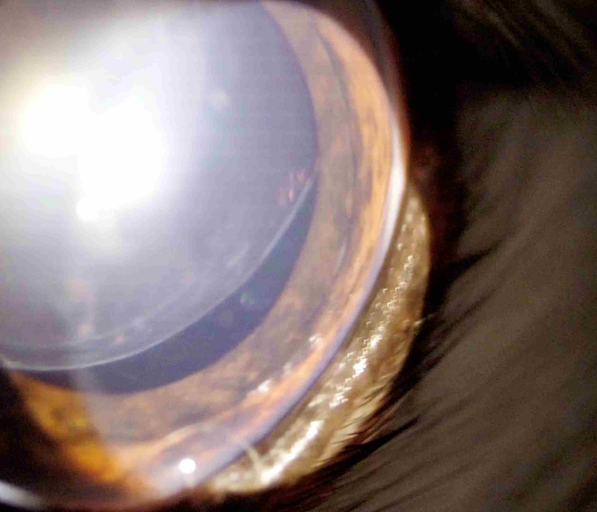 犬 水晶体亜脱臼