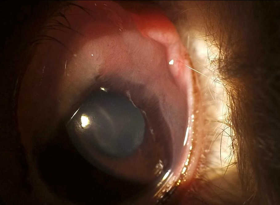 偽翼状片 うさぎ