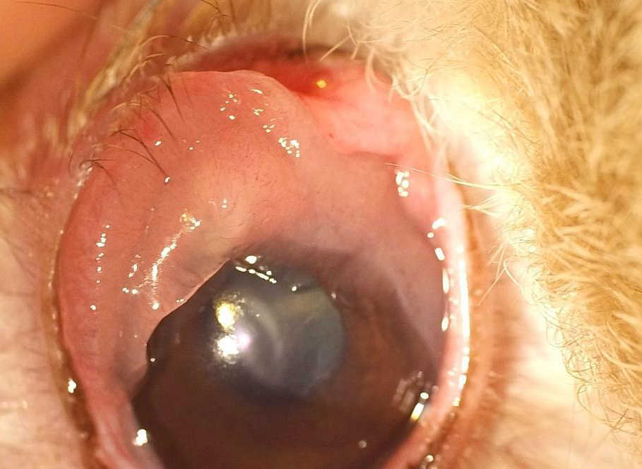 水晶体摘出術 術式