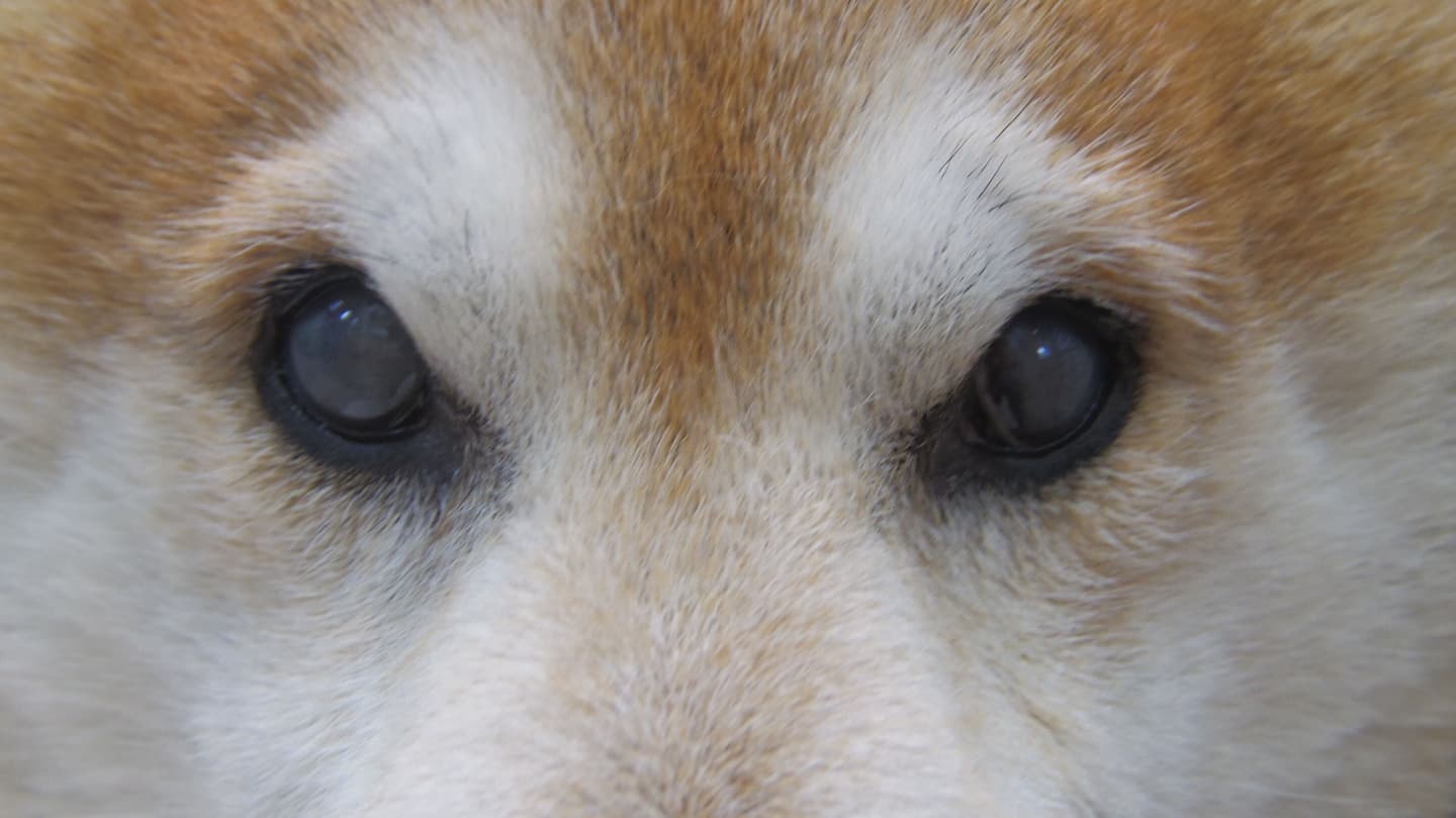 強膜内義眼挿入術　シリコンインプラント